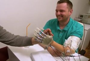 Italiana la prima mano bionica che parla al cervello
